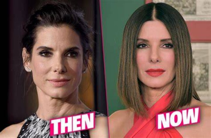 Sandra Bullock Frozen Face Result Of 'Fillers & Botox' Overload, Docs Claim