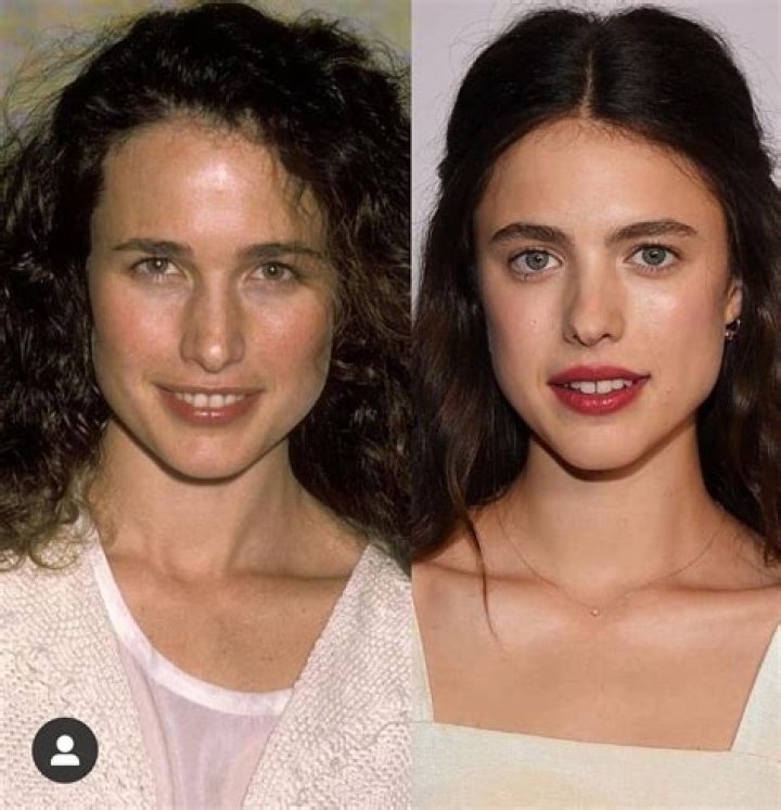 Shocking celebrity faces before and after Khloe Kardashian, Kim